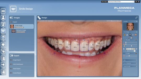 Smiledesign-539x303